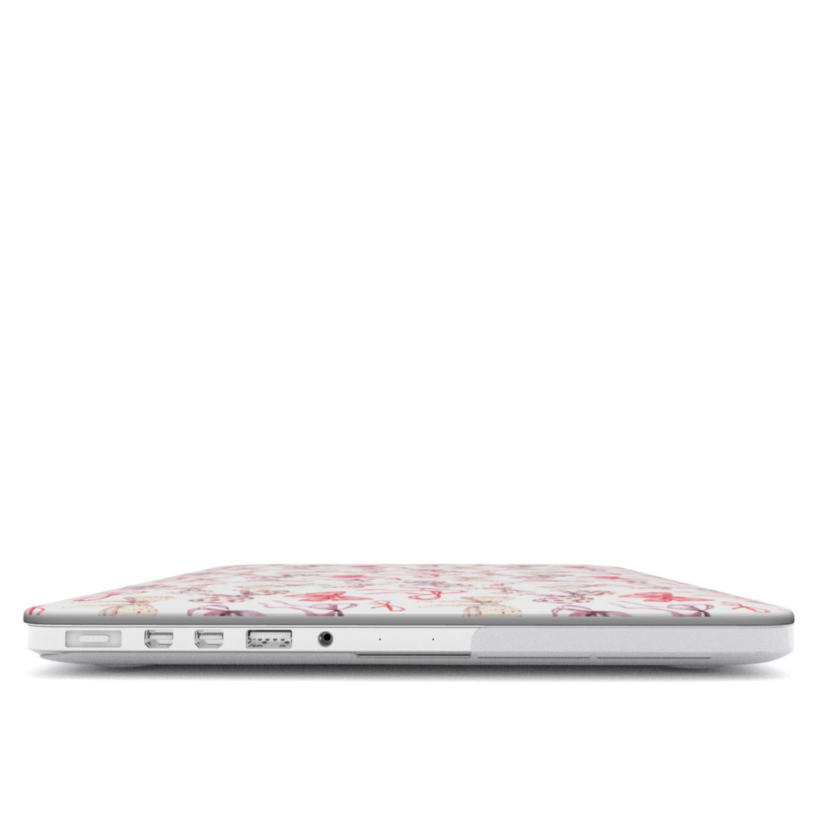 Coquette Bow MacBook Case Tech Accessories GalactiGuard   