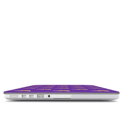 Electric Jolt Y2K MacBook Case Tech Accessories GalactiGuard   